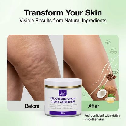 Nabros EPL Cellulite Firming Cream